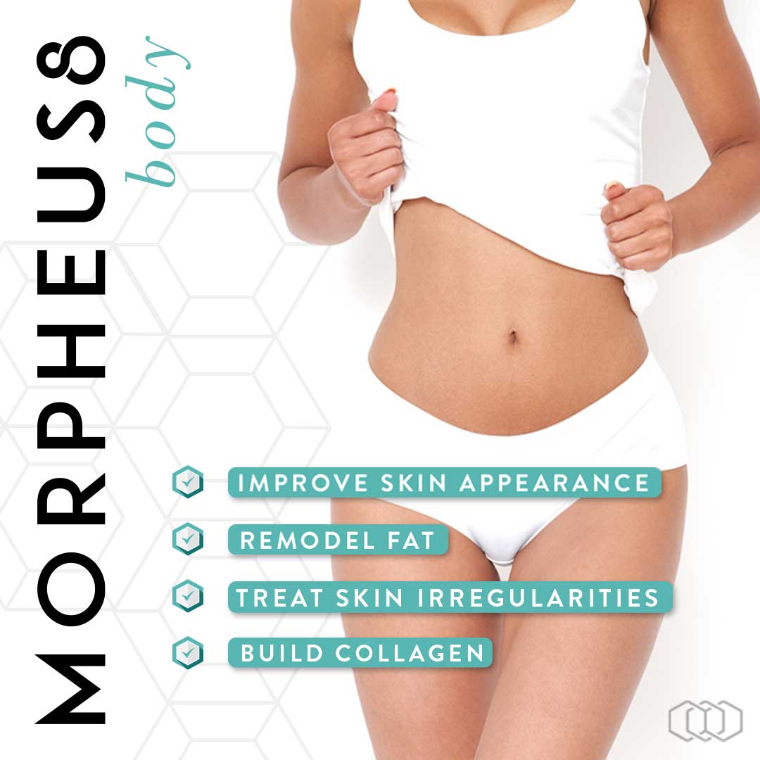 Morpheus 8 Benefits
